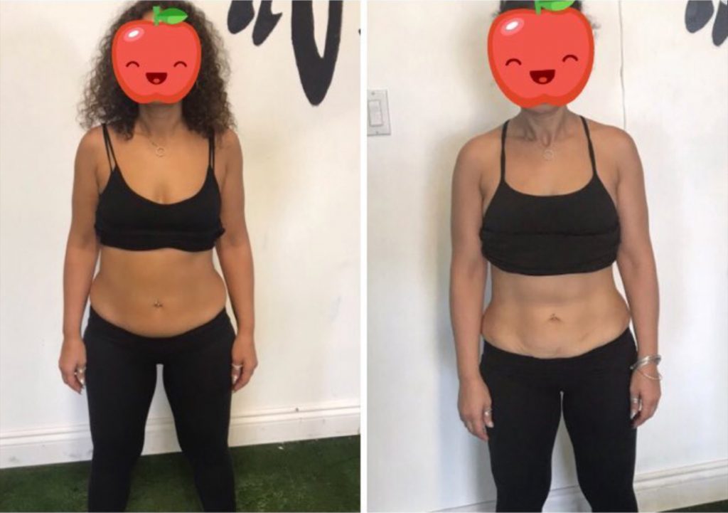 Get Our Gym Membership in Woodbridge MBS Fitness & Rehabilitation