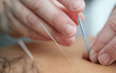 How Does Acupuncture Work?