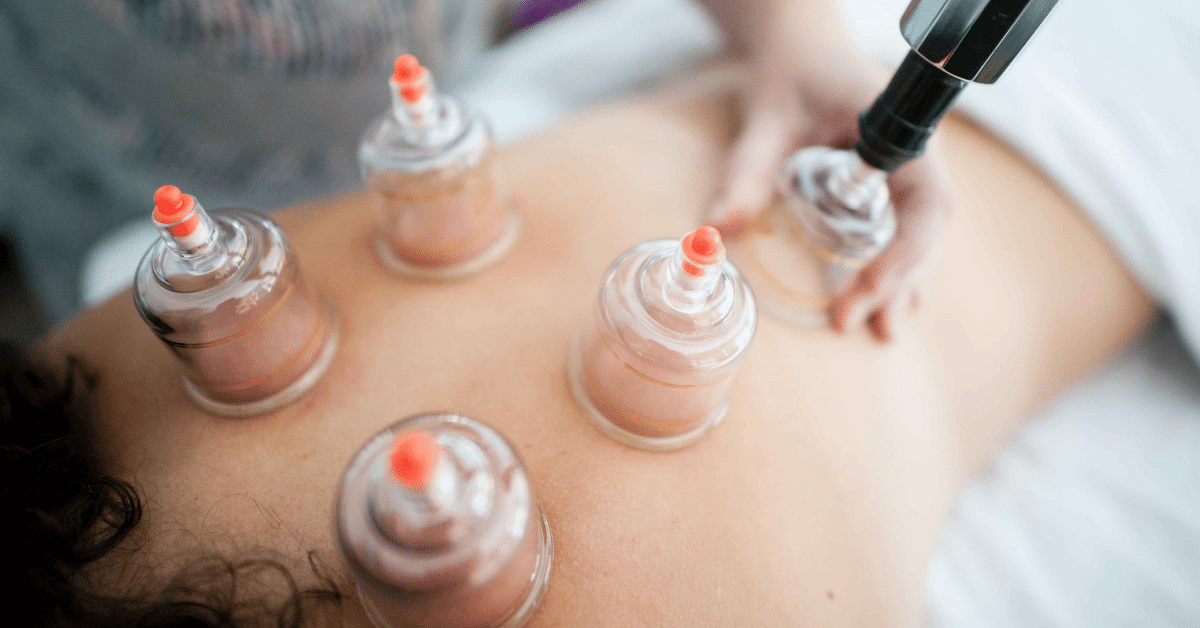 benefits of cupping therapy